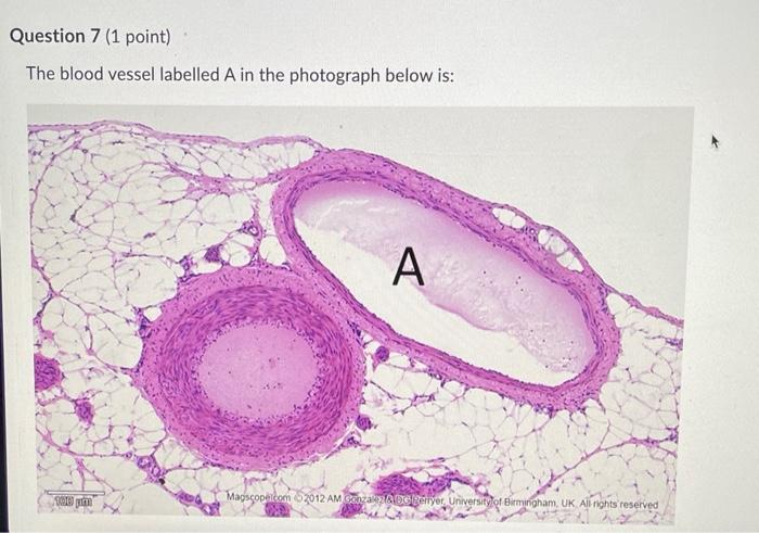 The blood vessel labelled \( A \) in the photograph below is: