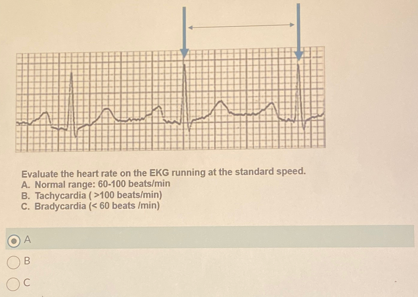 Solved Evaluate the heart rate on the EKG running at the | Chegg.com