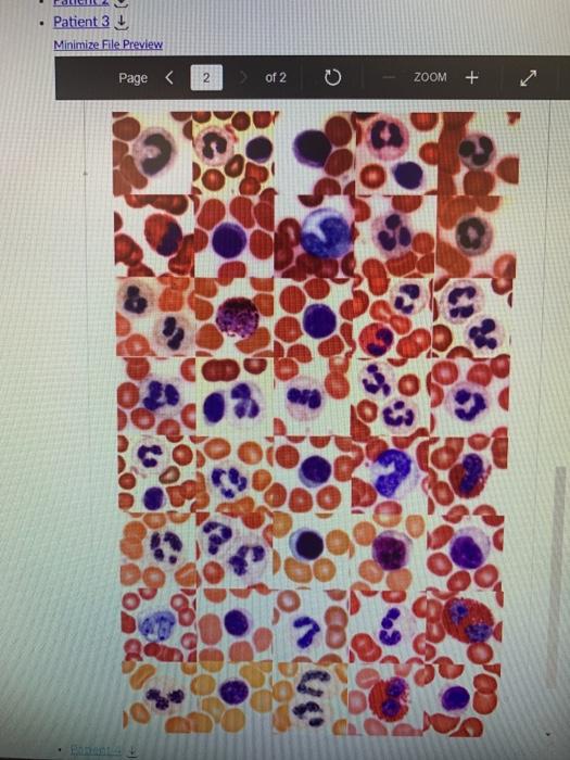 Solved Page 1 of 5 0 ZOOM + Case Study (Blood) Blood is | Chegg.com