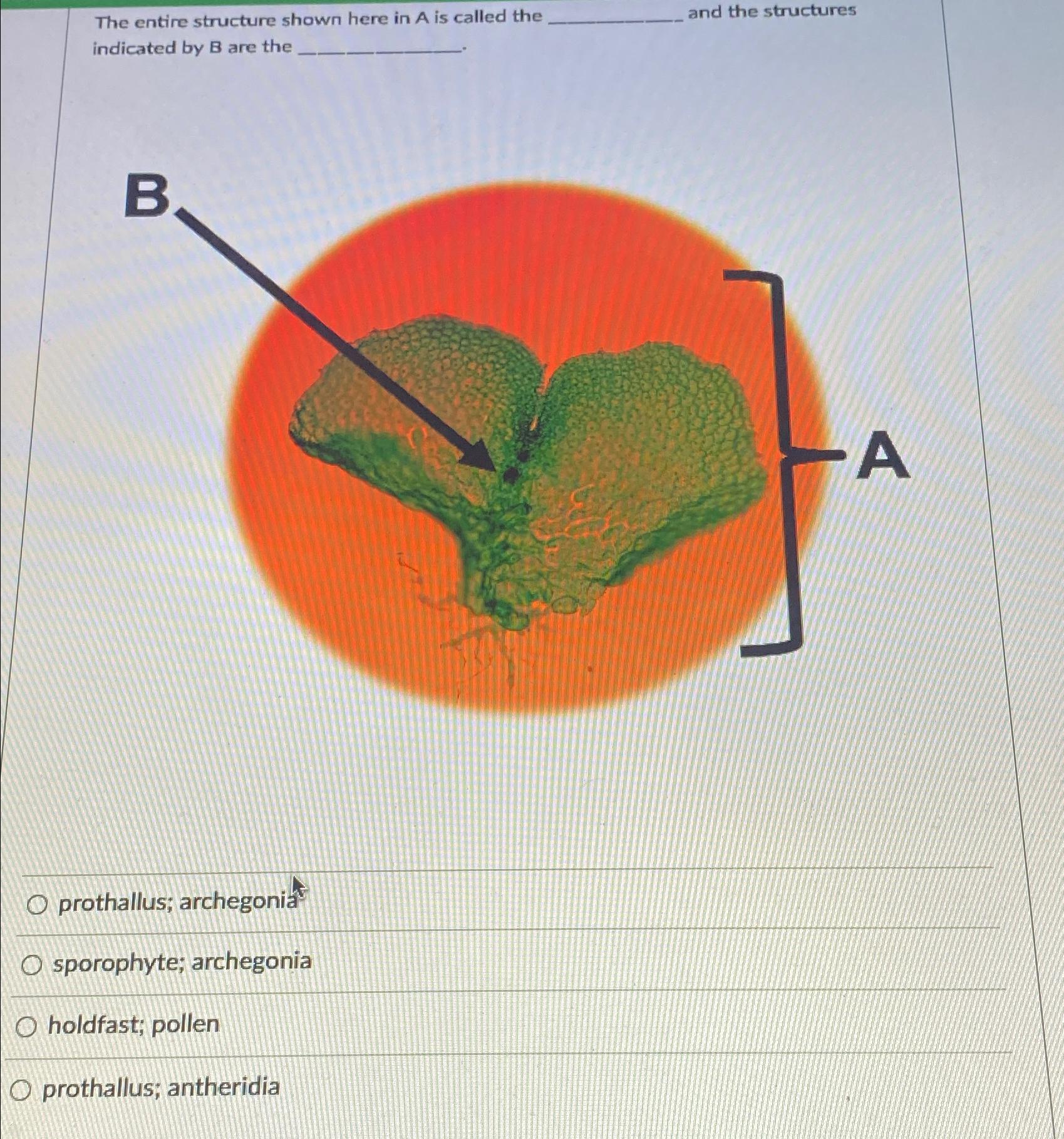 Solved The entire structure shown here in A is called the | Chegg.com