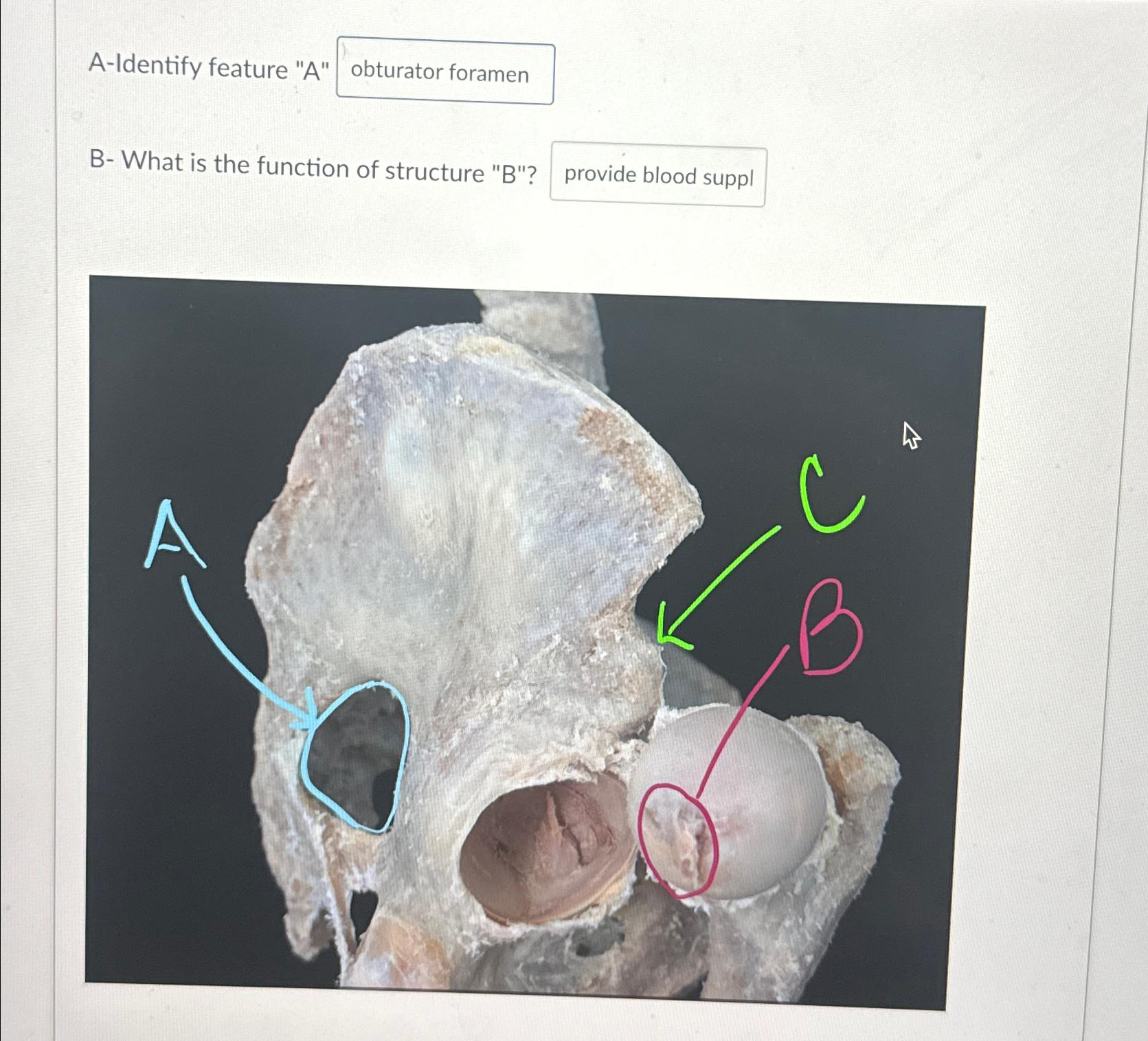 Solved A-Identify feature 