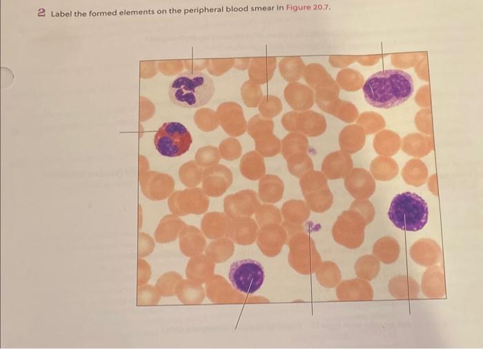 2 Label the formed elements on the peripheral blood smear in Figure 20.7.