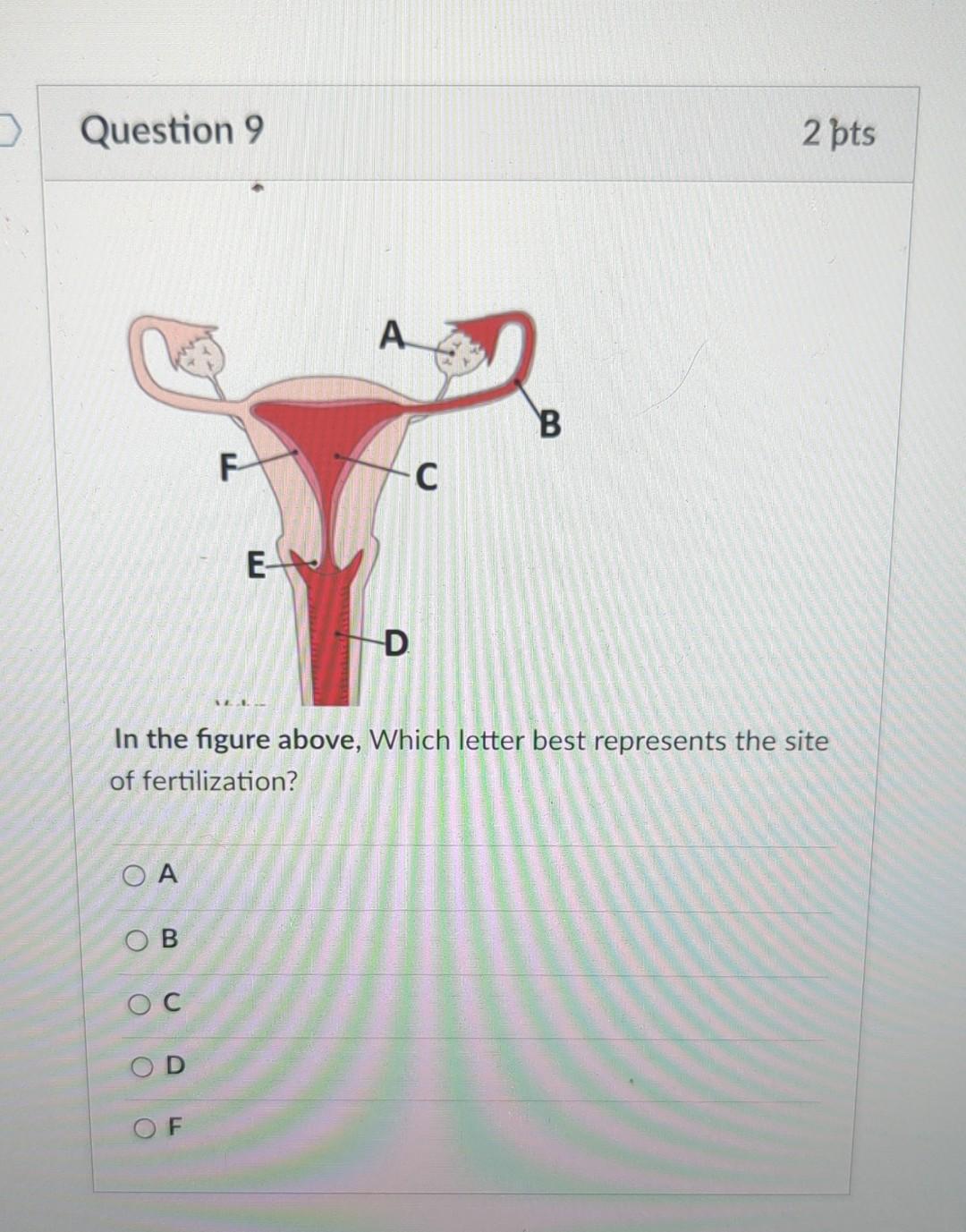 Solved Question 9 In the figure above, Which letter best | Chegg.com