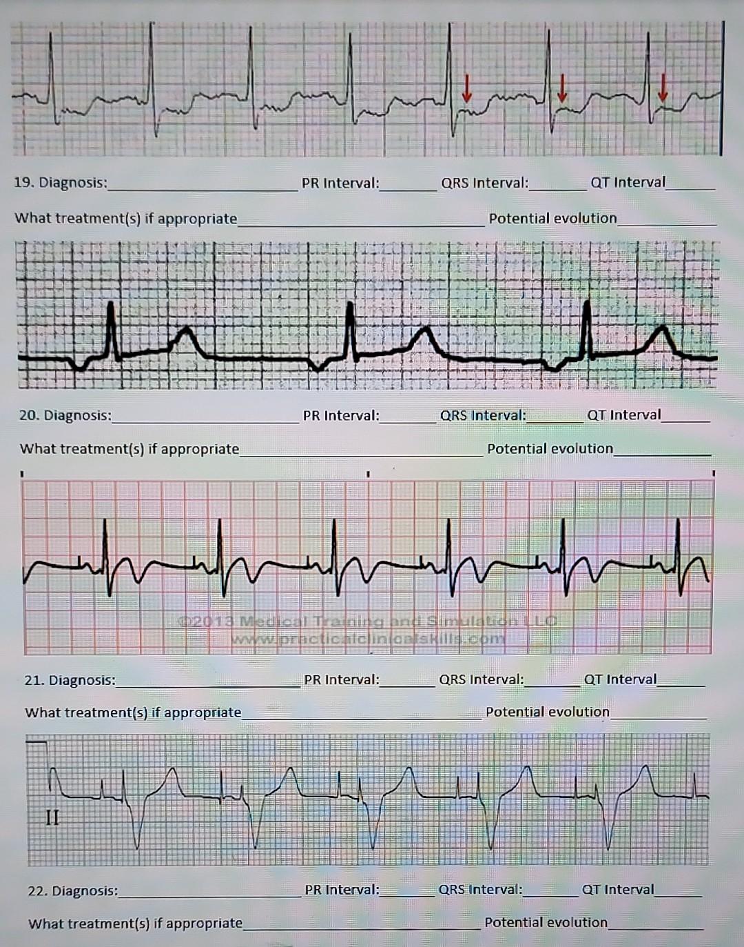 Solved السروالہ 19. Diagnosis: PR Interval: QRS Interval: QT | Chegg.com