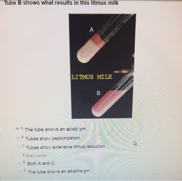 Solved Tube B Shows What Results In This Litmus Milk LITMUS | Chegg.com