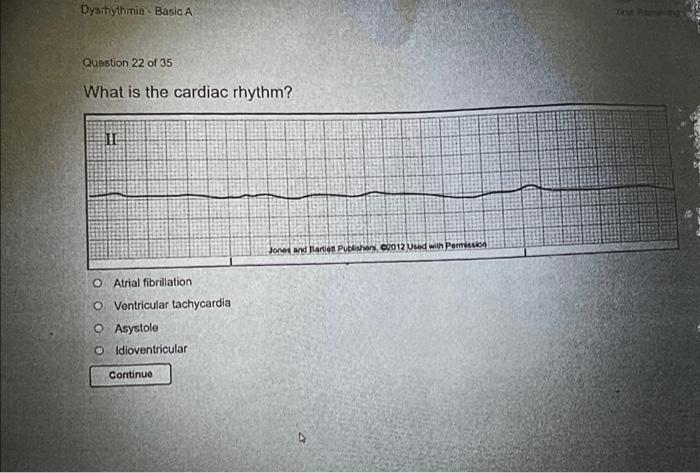 solved-dysrhythmia-basic-a-question-21-of-35-what-is-the-chegg