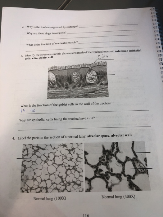 Solved 2. Why is the trachea supported by cartilage? Why are