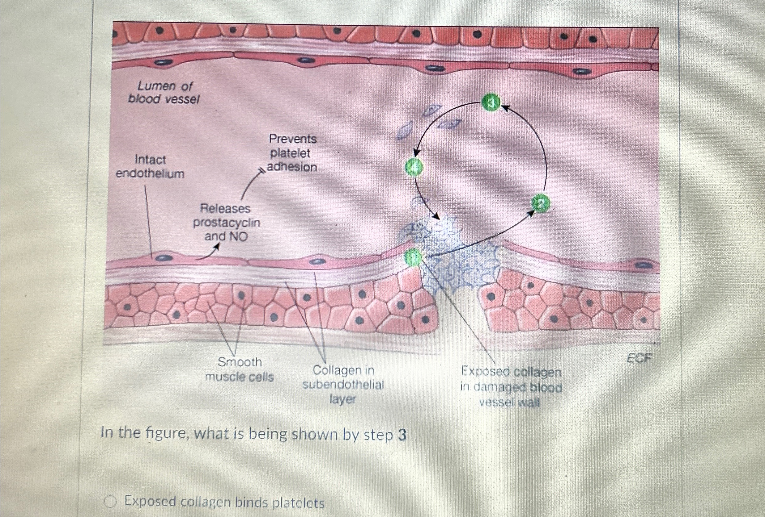 Solved In the figure, what is being shown by step 3Exposed | Chegg.com