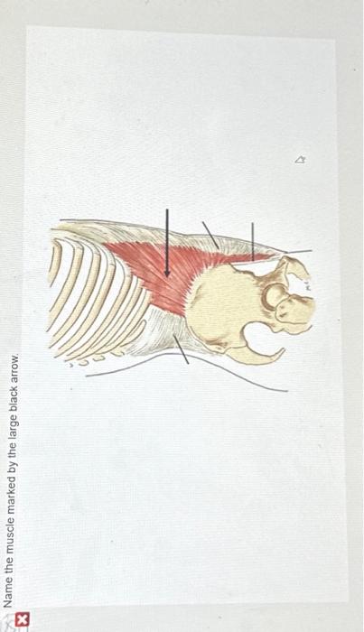Solved What muscle is marked by the letters E,F, and G. | Chegg.com