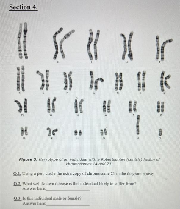 Solved Figure 1: Normal Human Male (46,XY ) Karyotype. | Chegg.com