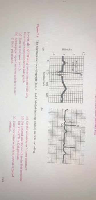 What Is The Pr Interval In This Ecg What Is The Ca Chegg Com