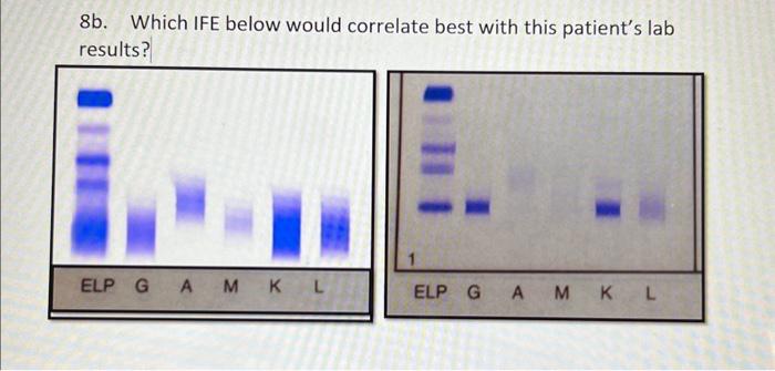 Solved CLINICAL IMMUNOLOGY can you please help me do 8a and | Chegg.com