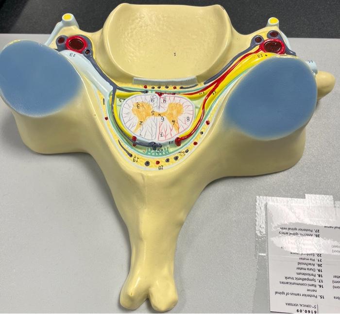 Solved 1. Body of 5n cervical vertebra 15. Posterior ramus | Chegg.com