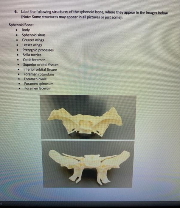sphenoid bone optic foramen