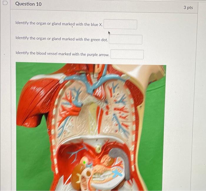 Solved D Question 10 3 pts Identify the organ or gland | Chegg.com