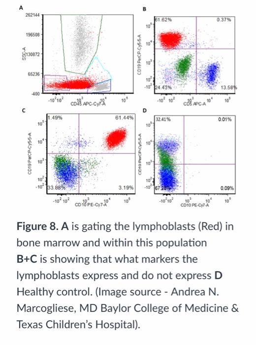 Solved Immunophenotypic Classification Of Childhood All 1) | Chegg.com