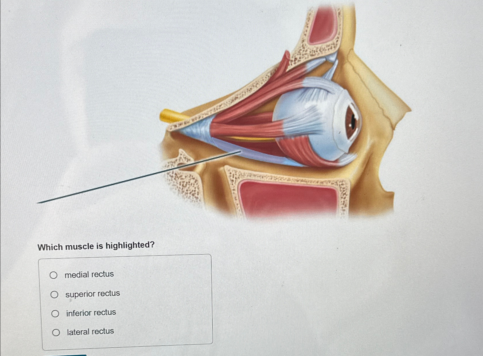Solved Which muscle is highlighted?medial rectussuperior | Chegg.com