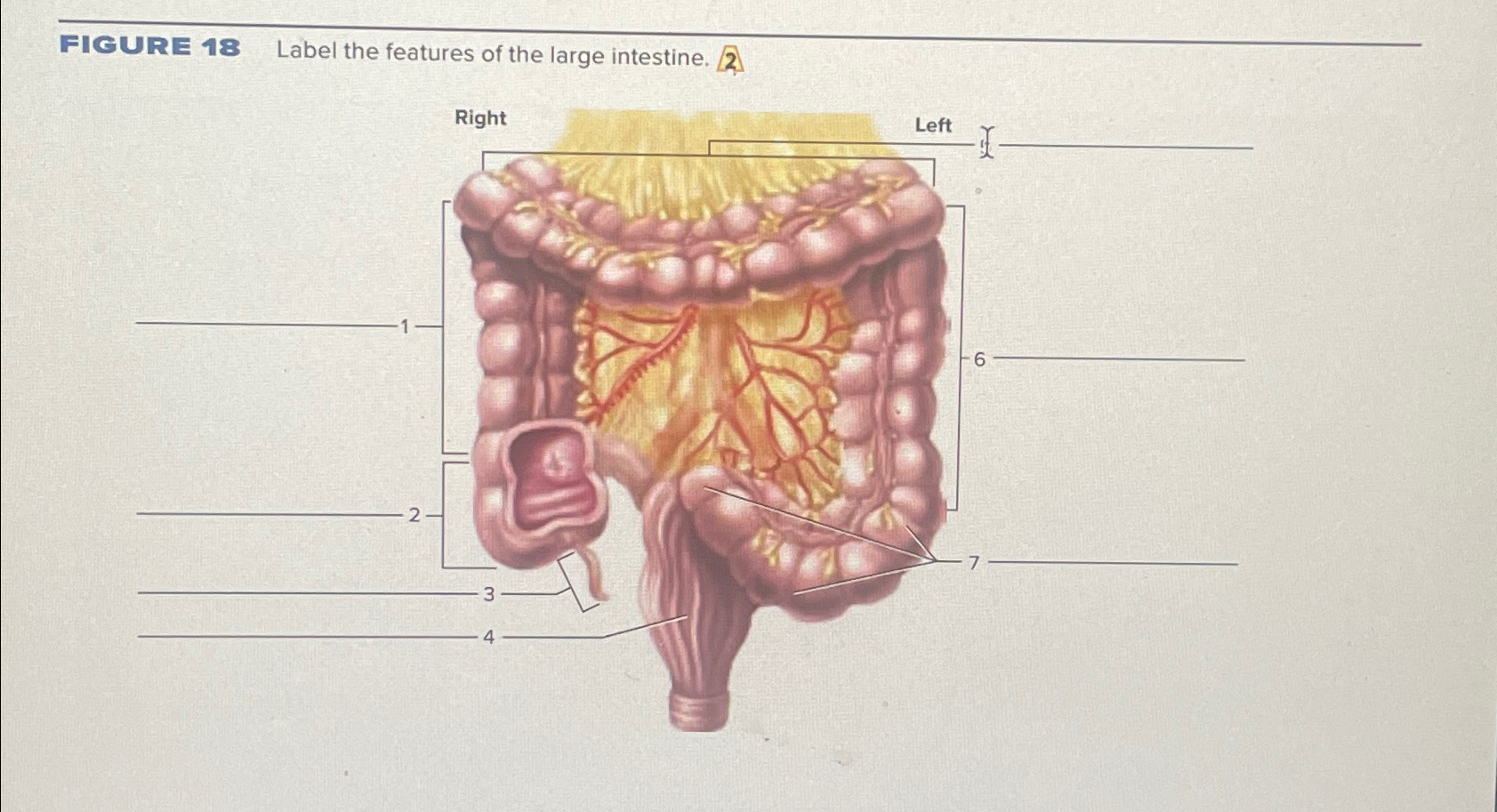 Solved FIGURE 18 ﻿Label the features of the large intestine. | Chegg.com