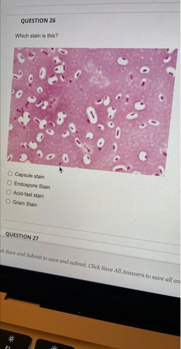 QUESTION 26
Which stain is this?
Endospore Stain
Acid-fast stain
Gram Stain
QUESTION 27
Eave and Stabmit to sabe and submit. 