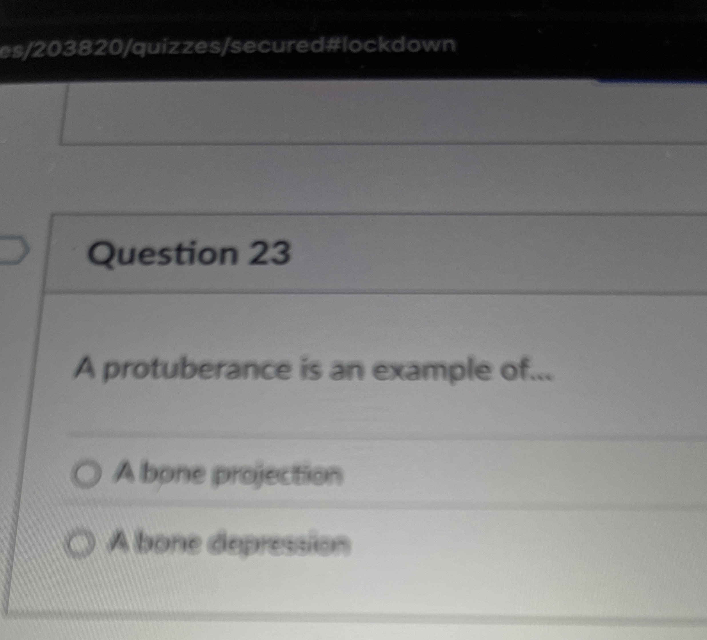 Solved Question 23A protuberance is an example of...A bone | Chegg.com