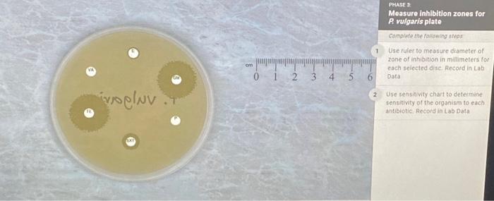 Solved Use ruler to measure diameter of rove of inhibition | Chegg.com