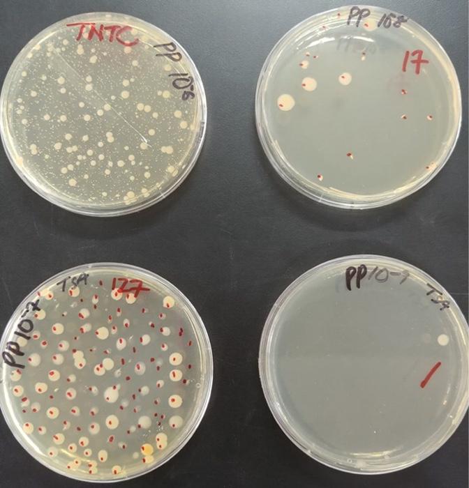 Solved MICROBIOLOGY Record the number of colonies on each