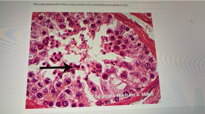 seminiferous tubules cross section