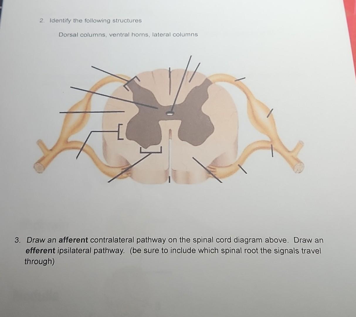 Lateral Column Solved 2. Identify the following structures Dorsal columns, | Chegg.com