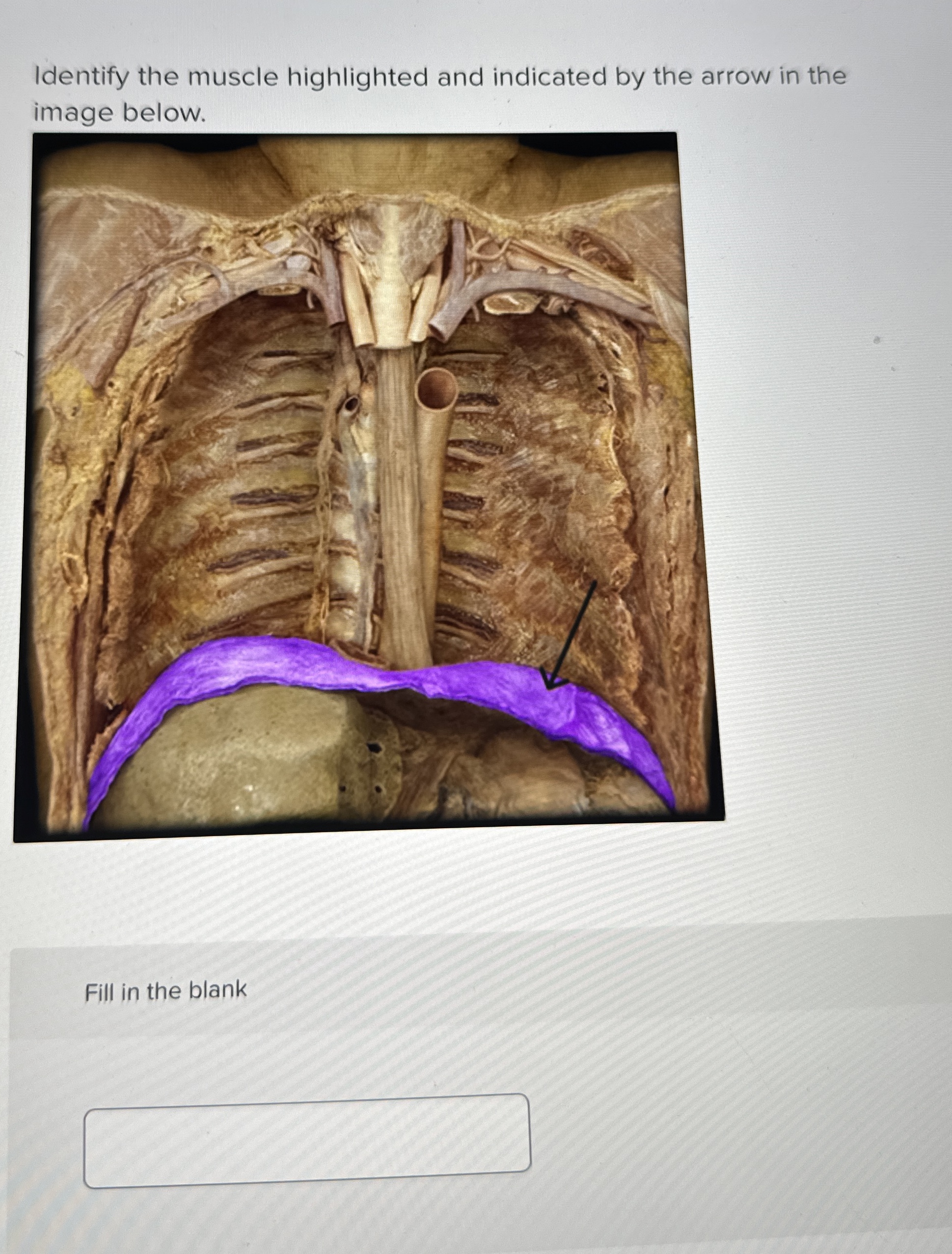 Image for question 10