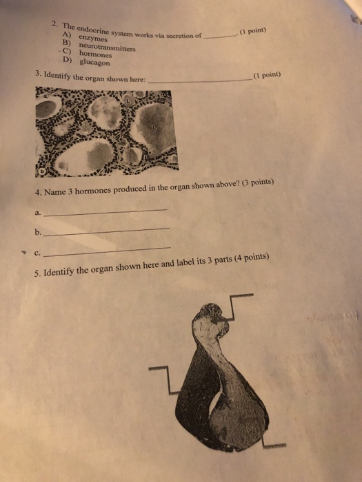 Solved (1 Point) The Endocrine System Works Via Secretion Of | Chegg.com