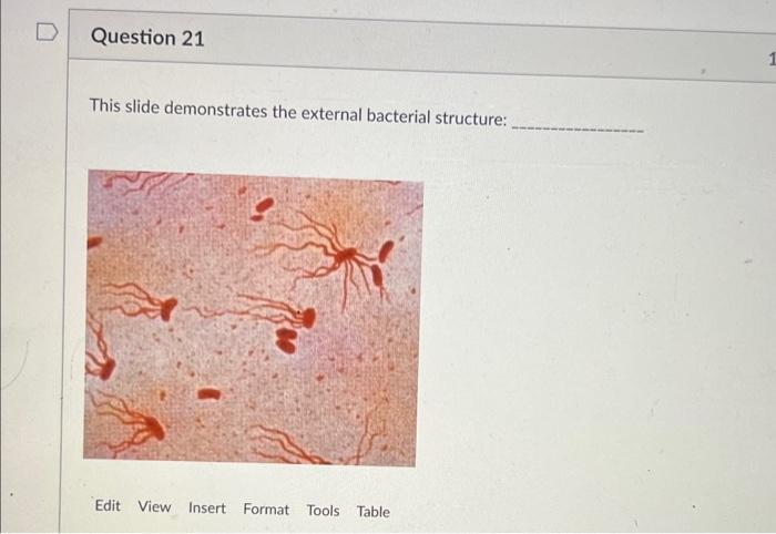 Solved Microbiology I WILL GIVE YOU THUMBS UP If You Answer | Chegg.com