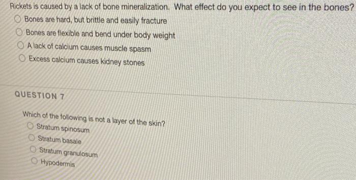 Solved Rickets is caused by a lack of bone mineralization. | Chegg.com