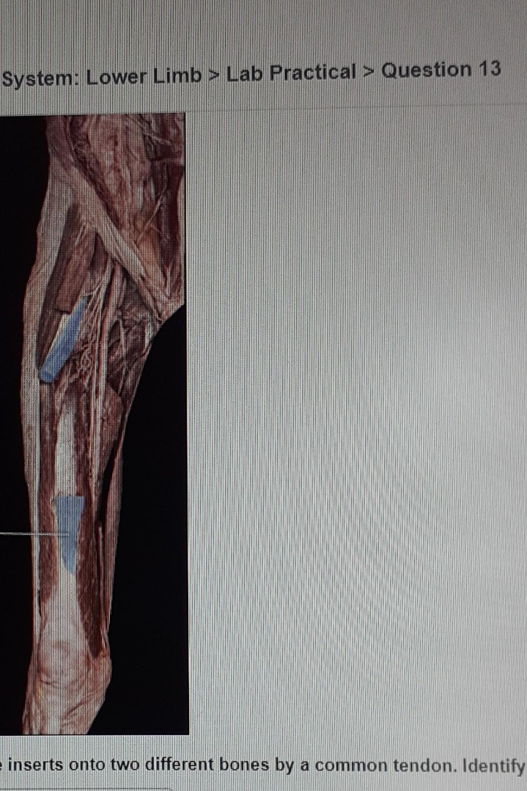 Solved the highlighted muscle inserts onto two different | Chegg.com