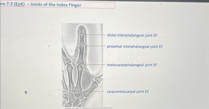 Solved metacarpophalangeal joint EF carpometacarpal | Chegg.com