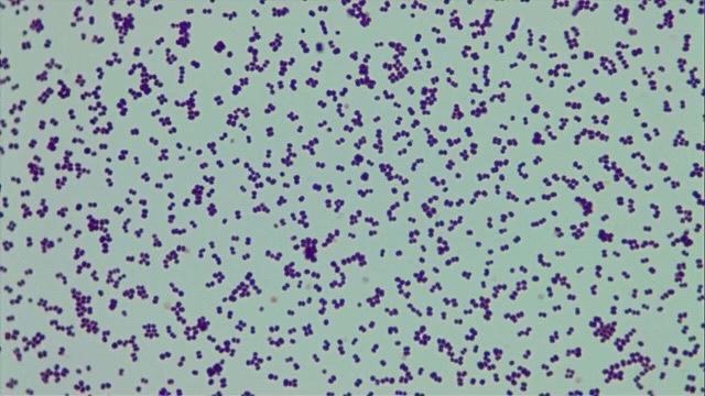 Solved Endospore Strain: Report the endospore reaction, | Chegg.com