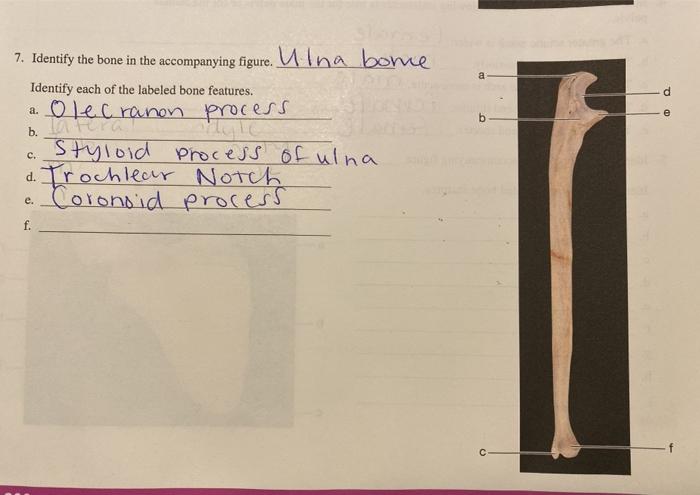 Solved 7. Identify the bone in the accompanying figure. Ulna | Chegg.com