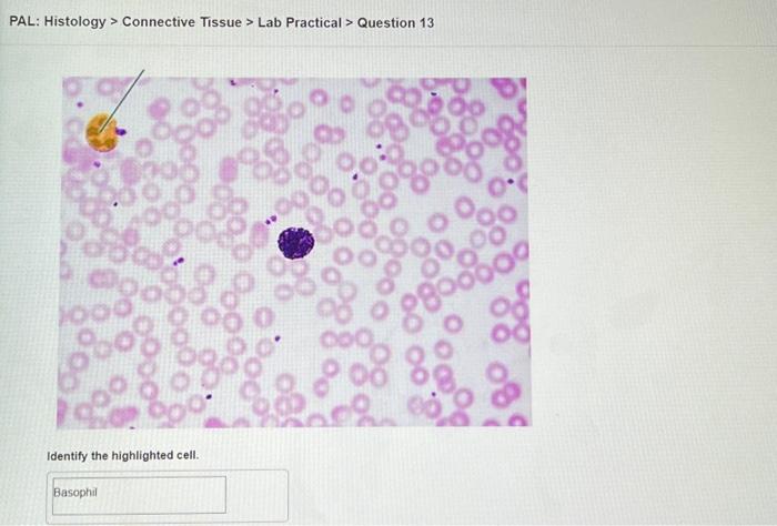 PAL: Histology \( > \) Connective Tissue \( > \) Lab Practical \( > \) Question 13
Identify the highlighted cell.