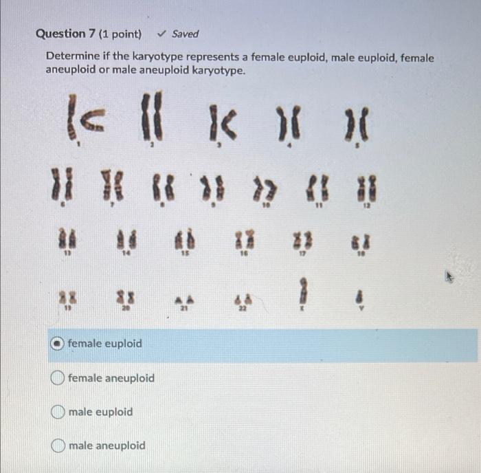 Solved Question 7 (1 point) Saved Determine if the karyotype | Chegg.com