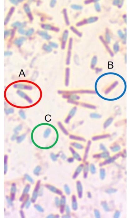 Solved A B ∞Identify This Stain. Endospore Capsule Gram | Chegg.com