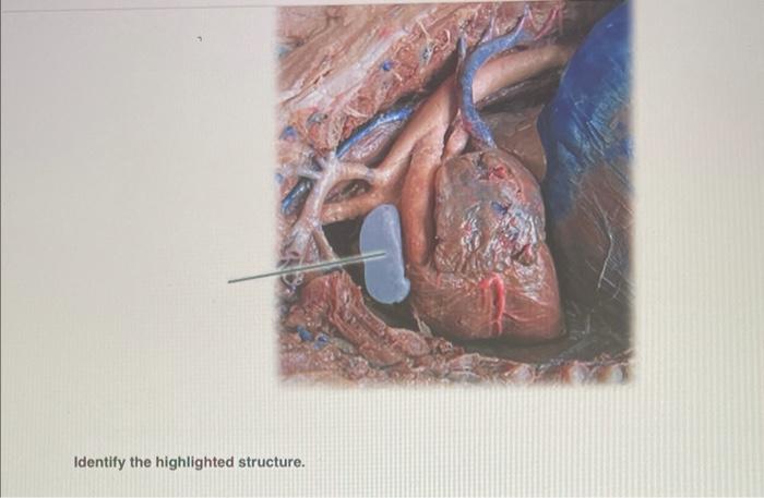 Identify the highlighted structure.