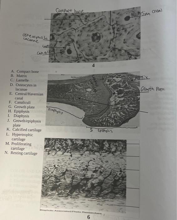 Solved A. Compact bone B. Matrix C. Lamelle D. Osteocytes in | Chegg.com