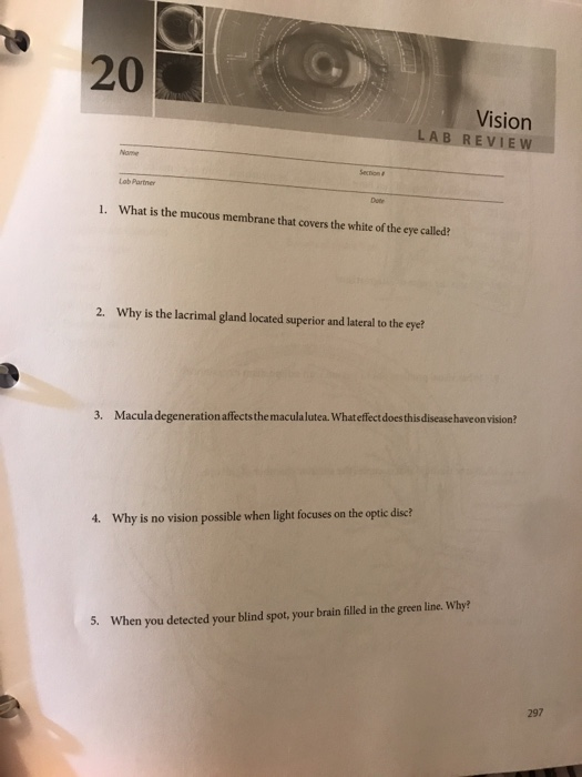 Solved Vision LAB REVIEW 1. What is the mucous membrane that | Chegg.com