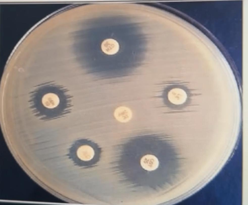 Solved Explain what the image is showing | Chegg.com