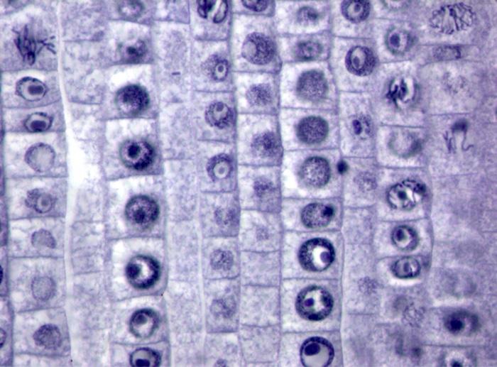 Solved how many cells that are in Anaphase stage in each | Chegg.com