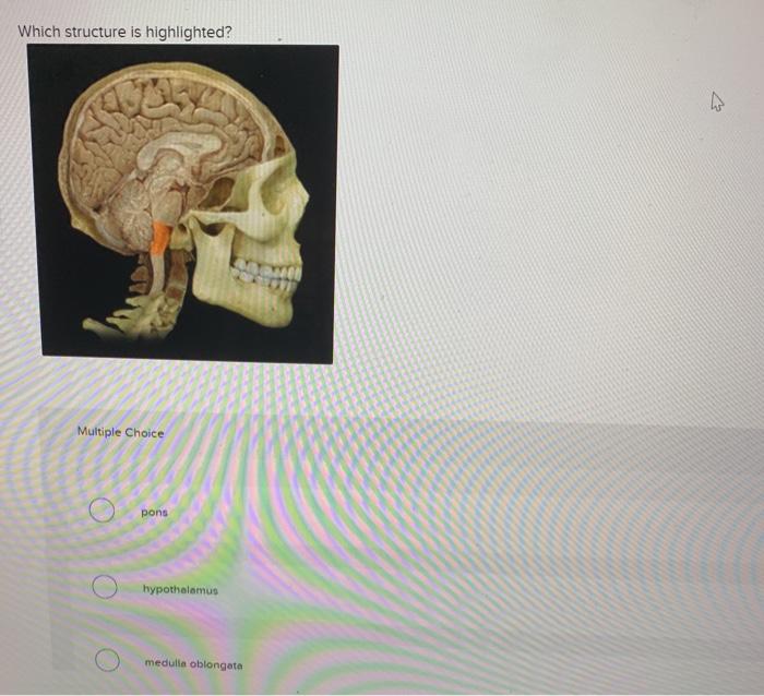 solved-which-structure-is-highlighted-4-multiple-choice-chegg