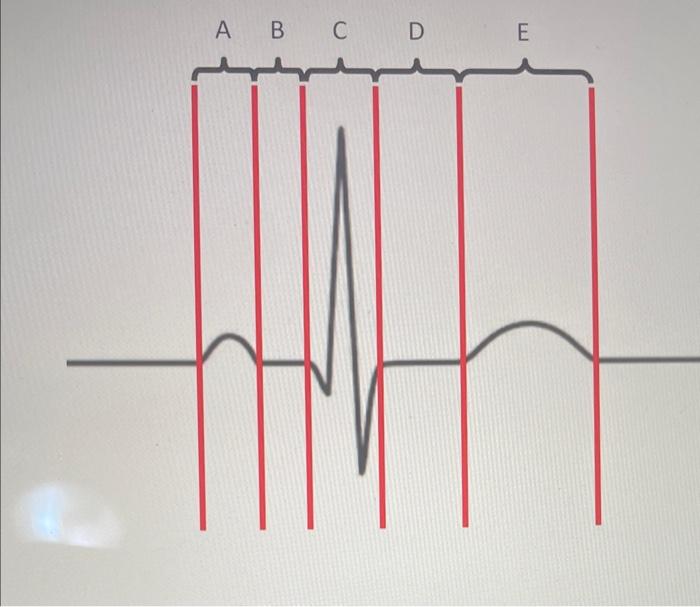 Solved Horizontal Calibration 4 cm/1sec Vertical