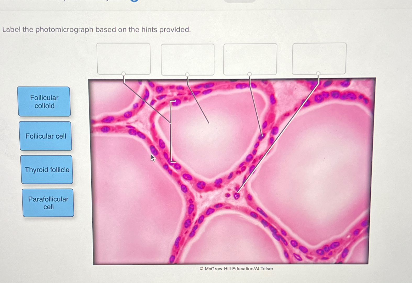 Solved Label The Photomicrograph Based On The Hints Chegg Com