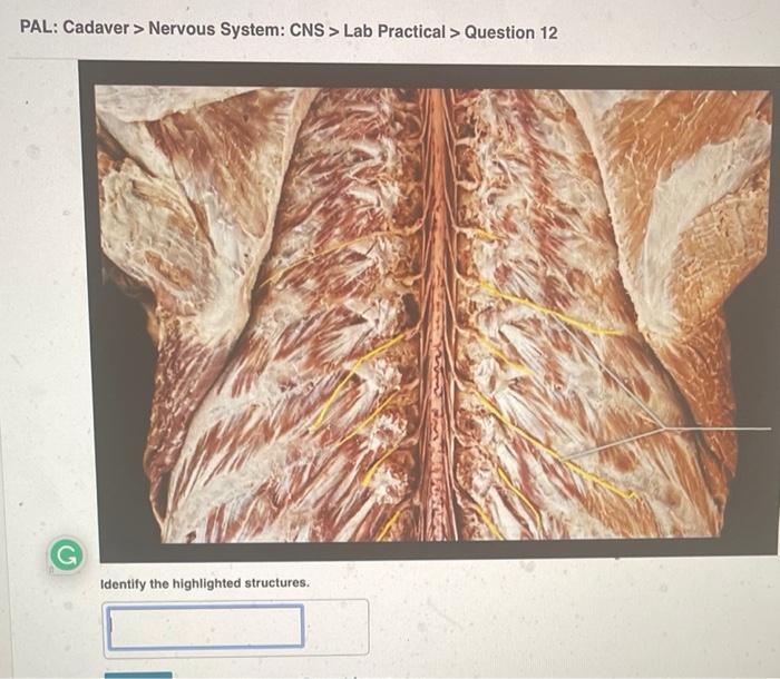 PAL: Cadaver > Nervous System: CNS > Lab Practical > Question 12
Identify the highlighted structures.