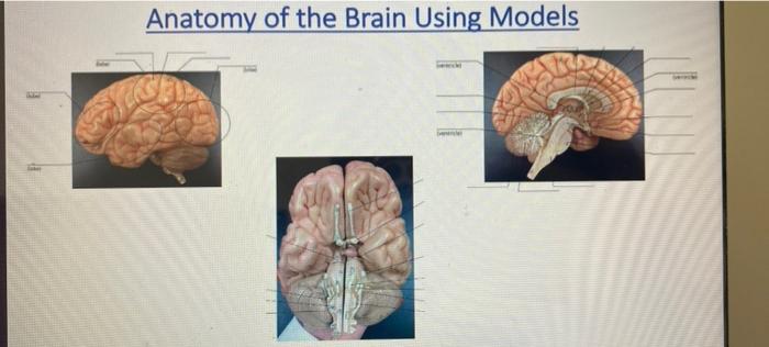Solved Anatomy of the Brain Using Models | Chegg.com