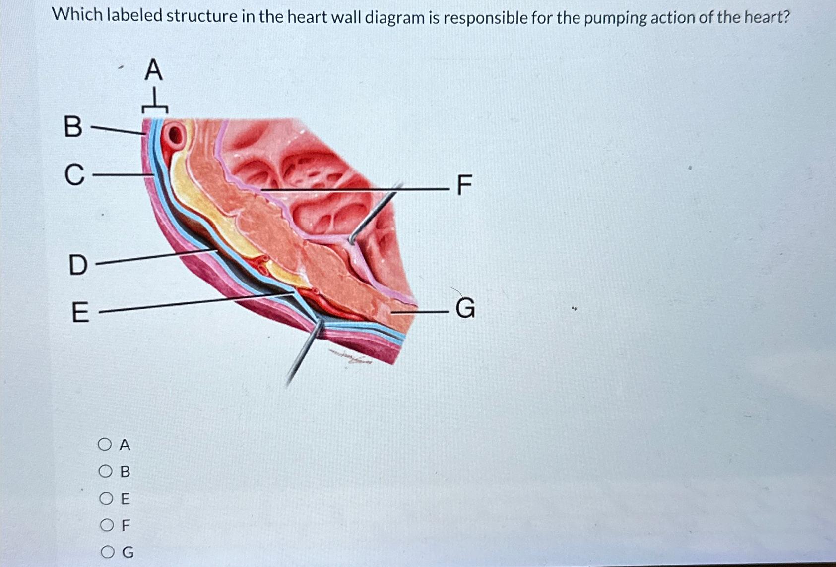 Solved Which labeled structure in the heart wall diagram is | Chegg.com